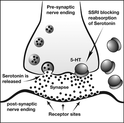 ssri-picture